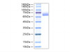 Recombinant Mouse Alkaline phosphatase (Intestinal type)/ALPI Protein (RPCB2118)