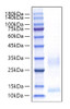 Recombinant Mouse CXCL9/MIG Protein (RPCB2119)