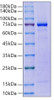 Recombinant Human GAS-6 Protein (RPCB2124)