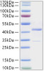 Recombinant Human PCBP1 Protein (RPCB2134)