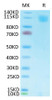 Biotinylated Recombinant SARS-CoV Spike S1 Protein (RPCB2149)