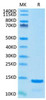 Recombinant Cynomolgus Beta-2-Microglobulin/B2M Protein (RPCB2170)