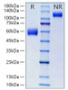 Recombinant Mouse NKG2-D/KLRK1/CD314 Protein (RPCB2181)