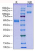 Recombinant Human Placenta growth factor/PlGF-131/PlGF-1 Protein (RPCB2188)