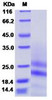 Recombinant Mouse PDGF-AA Protein (RPCB2195)