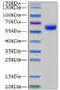 Recombinant Human Tripeptidyl-peptidase 1/TPP1 Protein (RPCB2197)