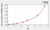 Human PRAME (Preferentially Expressed Antigen In Melanoma) ELISA Kit (AEKE08331)