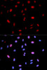 Anti-Phospho-MAP2K6-S207/MAP2K3-S189 Antibody (CABP0081)