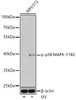 Anti-Phospho-p38 MAPK-Y182 Antibody (CABP0057)
