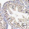 Anti-PI3 Kinase p85 beta [ARC0287] Monoclonal Antibody (CAB4860)