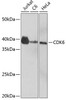 Anti-CDK6 [ARC0224] Monoclonal Antibody (CAB0106)