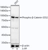 Anti-Phospho-beta-Catenin-S552 [ARC54001] Monoclonal Antibody (CABP1315)