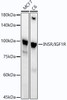 Anti-INSR/IGF1R [ARC54074] Monoclonal Antibody (CAB21984)
