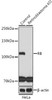Anti-RB Monoclonal Antibody (CAB3618)