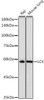 Anti-LCK Antibody (CAB2177)