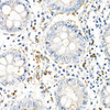 Anti-TNF-alpha [ARC52538] Monoclonal Antibody (CAB21265)
