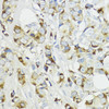 Anti-Complement Factor B Antibody (CAB1706)