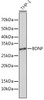 Anti-BDNF [ARC0303] Monoclonal Antibody (CAB4873)