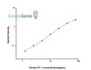 Human ET-1 (Endothelin 1) ELISA Kit (HUES01351)
