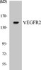 Cardiovascular VEGFR2 Colorimetric Cell-Based ELISA Kit