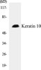 Keratin 10 Colorimetric Cell-Based ELISA Kit