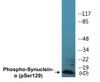 Synuclein-alpha Phospho-Ser129 Colorimetric Cell-Based ELISA Kit