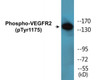 VEGFR2 Phospho-Tyr1175 Colorimetric Cell-Based ELISA Kit
