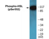 HSL Phospho-Ser552 Colorimetric Cell-Based ELISA Kit