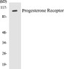 Epigenetics and Nuclear Signaling Progesterone Receptor Colorimetric Cell-Based ELISA Kit