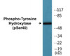 Tyrosine Hydroxylase Phospho-Ser40 Colorimetric Cell-Based ELISA Kit