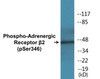 Adrenergic Receptor beta2 Phospho-Ser346 Colorimetric Cell-Based ELISA Kit