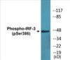 IRF-3 Phospho-Ser386 Colorimetric Cell-Based ELISA Kit