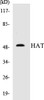 HAT Colorimetric Cell-Based ELISA Kit