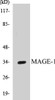 Epigenetics and Nuclear Signaling MAGE-1 Colorimetric Cell-Based ELISA Kit