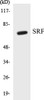 Epigenetics and Nuclear Signaling SRF Colorimetric Cell-Based ELISA Kit