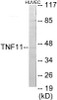 Developmental Biology TNFSF11 Colorimetric Cell-Based ELISA
