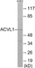 Cardiovascular ACVL1 Colorimetric Cell-Based ELISA