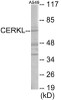 CERKL Colorimetric Cell-Based ELISA