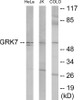 Signal Transduction GRK7 Colorimetric Cell-Based ELISA