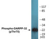 DARPP-32 Phospho-Thr75 Colorimetric Cell-Based ELISA Kit