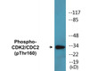 CDK2 Phospho-Thr160 Colorimetric Cell-Based ELISA Kit
