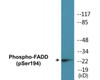 FADD Phospho-Ser194 Colorimetric Cell-Based ELISA Kit