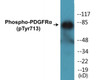 PDGFRalpha Phospho-Tyr713 Colorimetric Cell-Based ELISA Kit