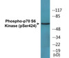 p70 S6 Kinase Phospho-Ser424 Colorimetric Cell-Based ELISA Kit