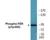 FER Phospho-Tyr402 Colorimetric Cell-Based ELISA Kit