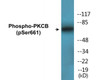 PKCB Phospho-Ser661 Colorimetric Cell-Based ELISA Kit