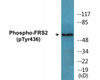 FRS2 Phospho-Tyr436 Colorimetric Cell-Based ELISA Kit