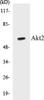 Cell Death Akt2 Colorimetric Cell-Based ELISA Kit