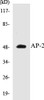 Epigenetics and Nuclear Signaling AP-2 Colorimetric Cell-Based ELISA Kit