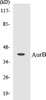 Cell Cycle ELISA Kits AurB Colorimetric Cell-Based ELISA Kit